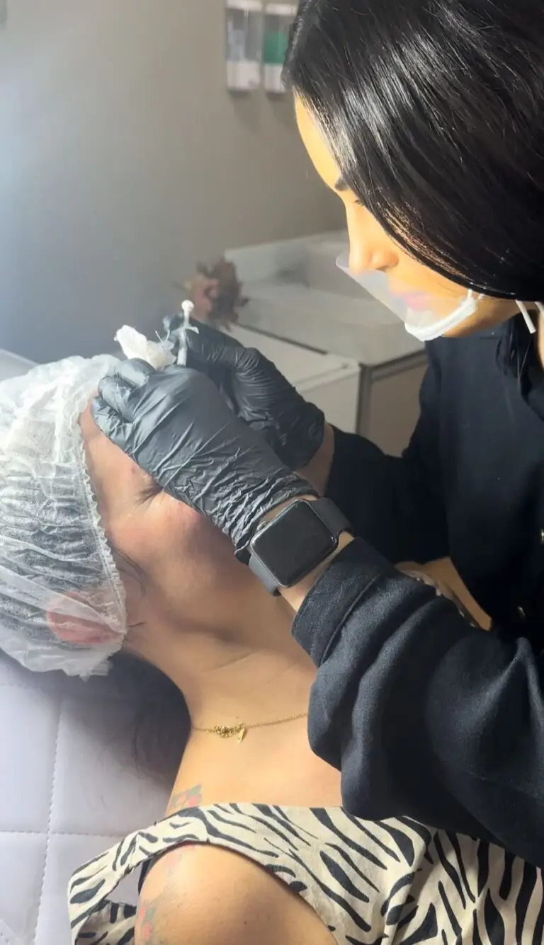 botox - tocina botulinica - belo horizonte